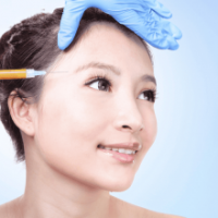 CẤY MỠ THÁI DƯƠNG TỰ THÂN: LÀM ĐẦY VÙNG HÓP, CẢI THIỆN TƯỚNG SỐ RẠNG NGỜI