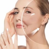 Phân Biệt Căng Da Mặt Bán Phần Và Toàn Phần: Lựa Chọn Nào Phù Hợp Với Bạn?