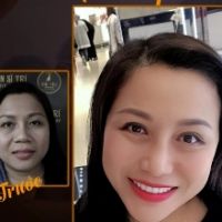 Vì sao nên phẫu thuật thẩm mỹ tại Thẩm mỹ viện Tiến Sĩ Trí?