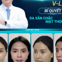 Căng Da Mặt Toàn Phần V-Line Cùng TS.BS Đỗ Thành Trí: Đảo Ngược Lão Hóa, Tái Sinh Viền Hàm Trẻ Đẹp B