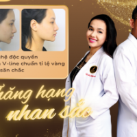 Trượt Cằm Là Gì? Giải Pháp Kiến Tạo Cằm V-line Hoàn Hảo tại Thẩm Mỹ Viện Dr. Trí